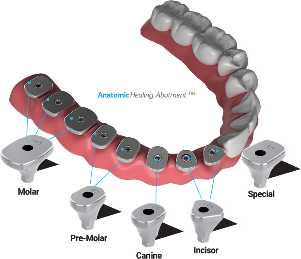 Anatomic Healing abutment